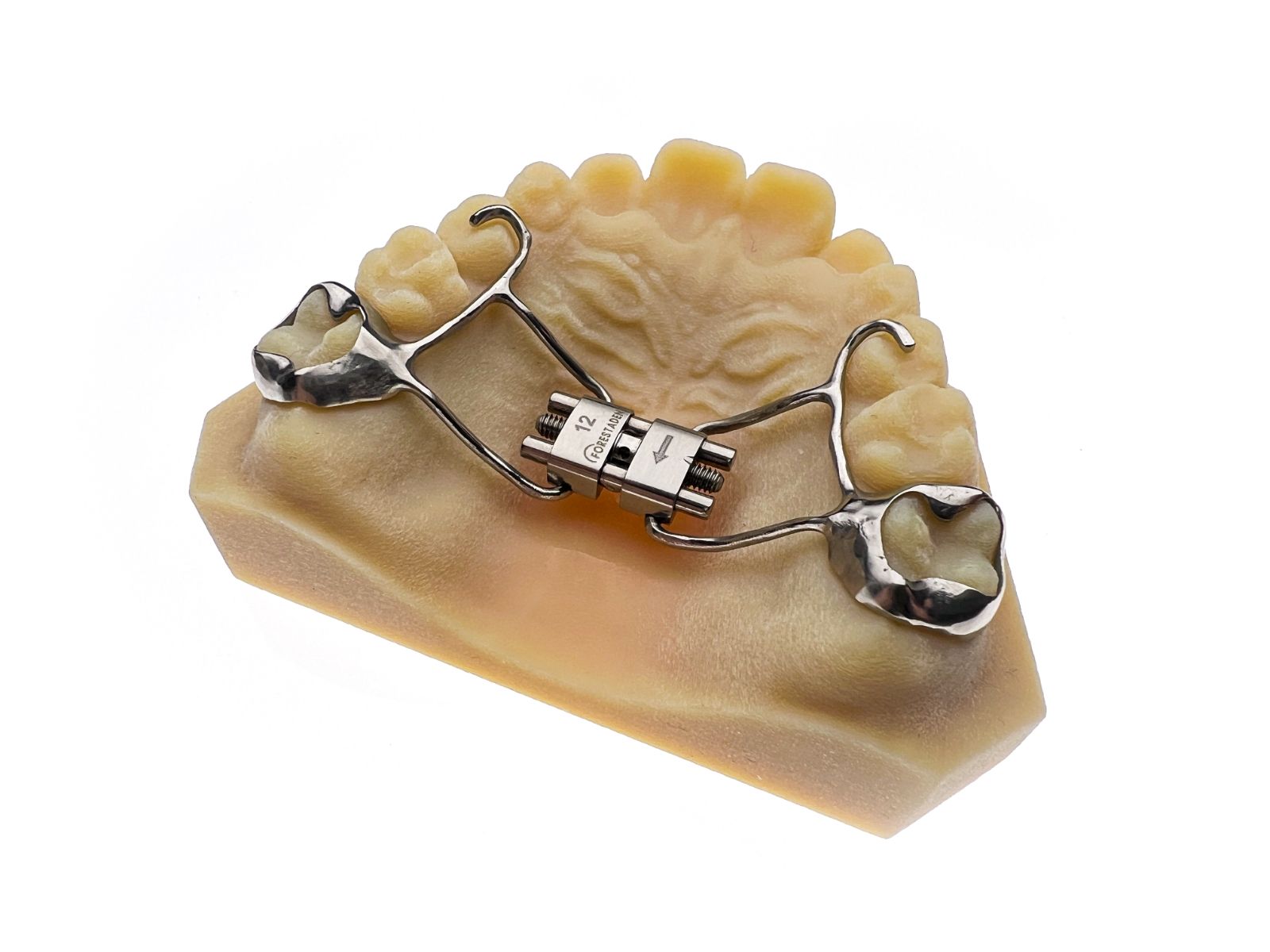 Fixed Metals - Dobson Ortho Laboratory