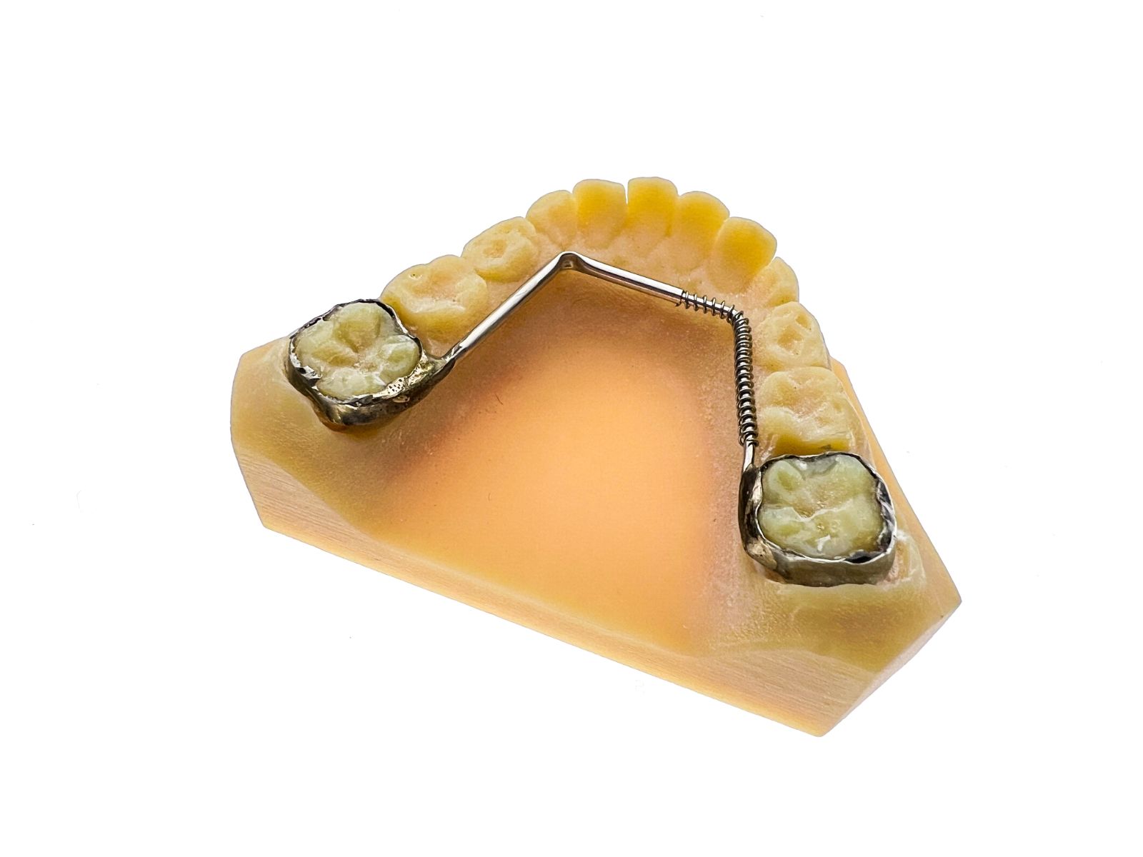 Fixed Metals - Dobson Ortho Laboratory