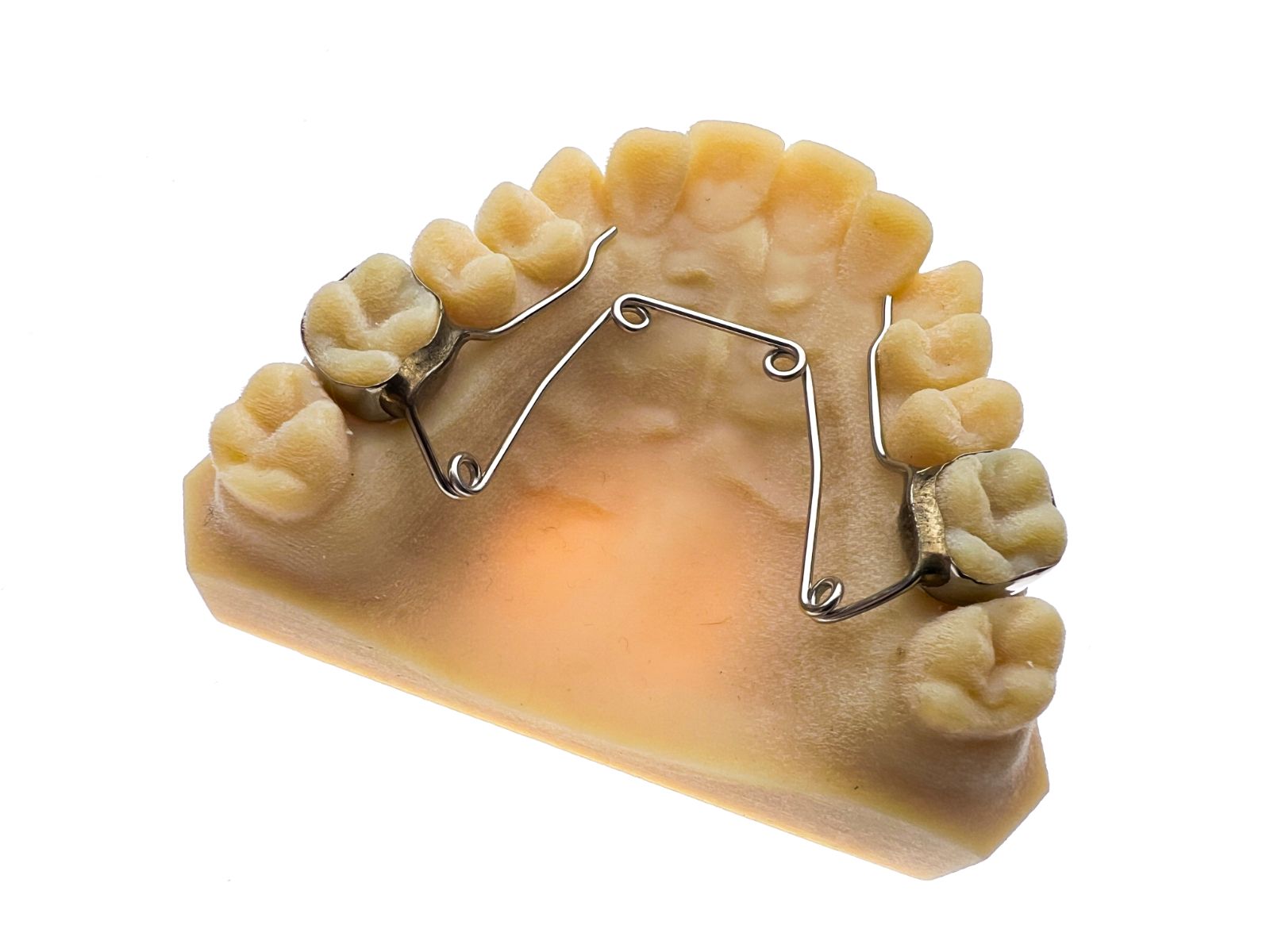 Fixed Metals - Dobson Ortho Laboratory